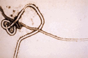 Ebola virus v elektronovém mikroskopu