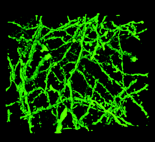 Neuróny myšieho mozgu