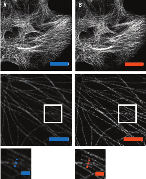 Fotografia mikrotubulov z ľudskej ľadvinovej embrionálnej bunky HEK293