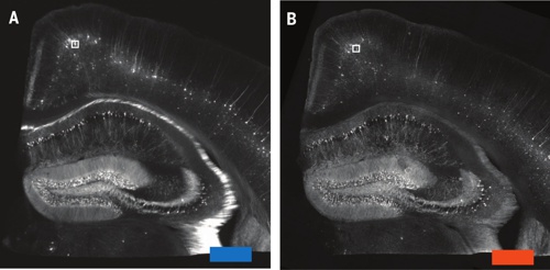 Fotografia rezu z tkaniva myšieho mozgu