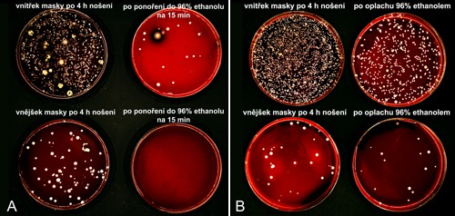 Přirozeně kontaminovaná PLA polomaska dezinfikovaná etanolem. (A) ponoření do etanolové lázně po dobu 15 min, (B) oplach etanolem ze střičky.