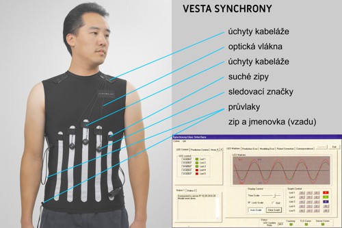 Vesta Synchrony pro přesné (Respiratory Tracking) ozařování nádorů 