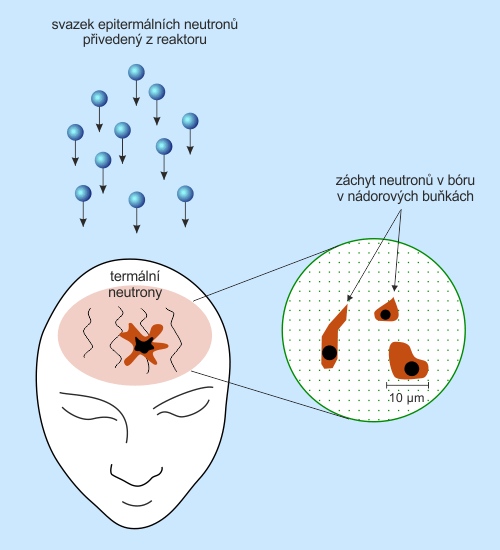 Schéma biologického principu bór-neutronové záchytové terapie