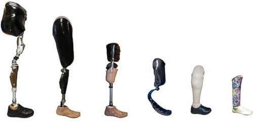 V současnosti je většina dostupných protéz pro osoby s nadkolenní amputací tvořena pasivními zařízeními