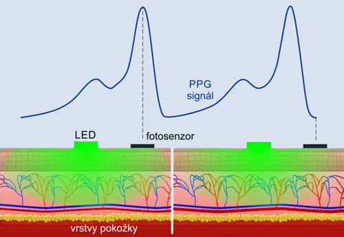 Princip funkce PPG senzoru. Dilatace tepen zvyšuje absorpci světla.