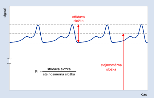 Perfuzní index